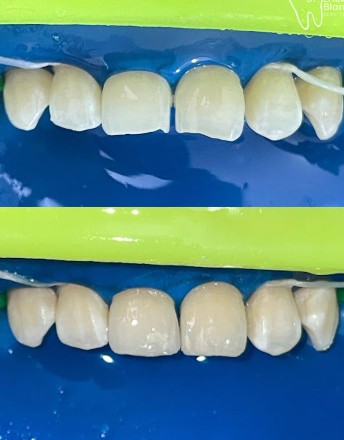 Registro fotográfico dental de un resultado clínico