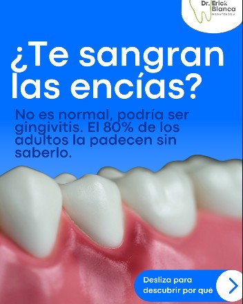 Contenido educativo sobre sangrado de encías